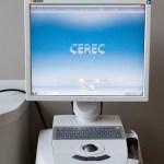 CEREC display monitor