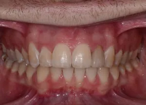 Orthodontics patient 3