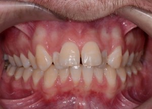 Orthodontics patient 3