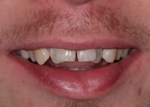 Orthodontics patient 3