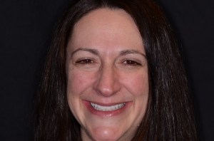 Orthodontics patient 2