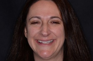 Orthodontics patient 2