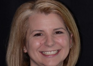 Orthodontics patient 1