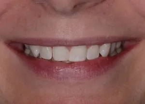 Orthodontics patient 1