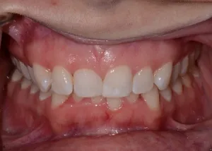 Orthodontics patient 1