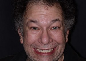 Complete Smile Makeover patient 5