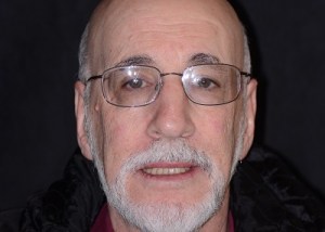 Complete Smile Makeover patient 3